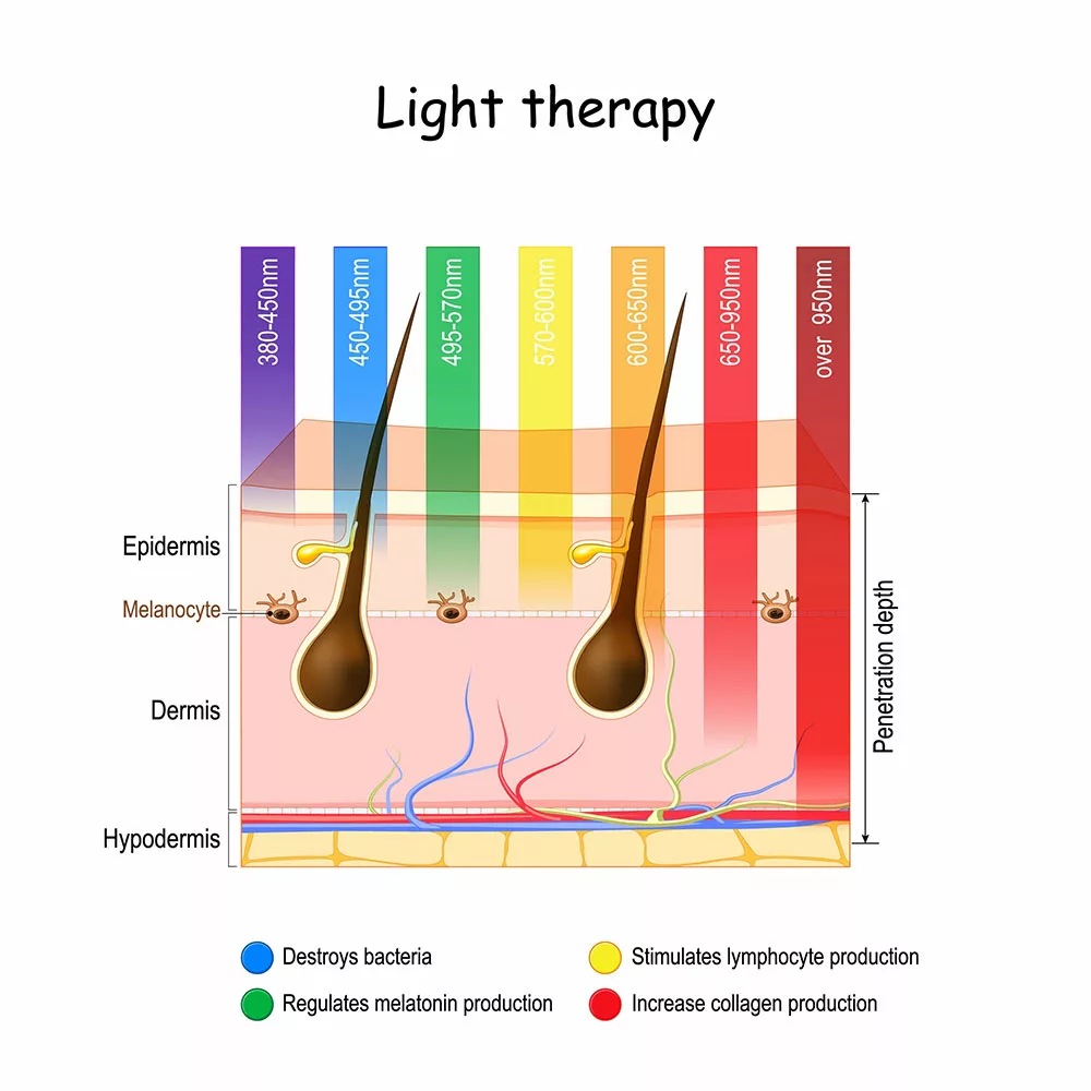 Light therapy